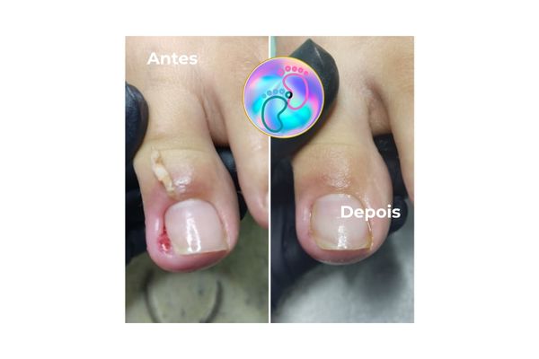 Foto de antes e depois do tratamento 49